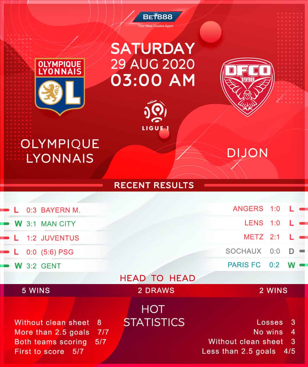 Olympique Lyonnais vs Dijon 29/08/20
